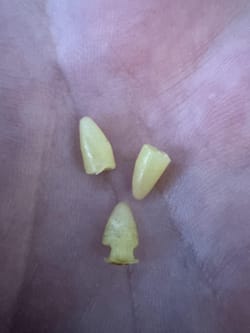 found hundreds of tiny plastic cones everywhere