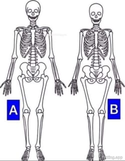 Can you tell me which skeleton is a girl