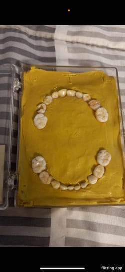 The creative ways parents find to preserve their kids' baby teeth